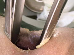 Massive horse speculum, double fisting, doctor, super nurse