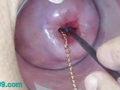 Extreme Cervix Playing with Insertion Metal Chain in Uterus