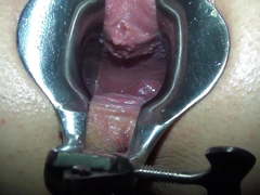 Fucking small german girl with speculum